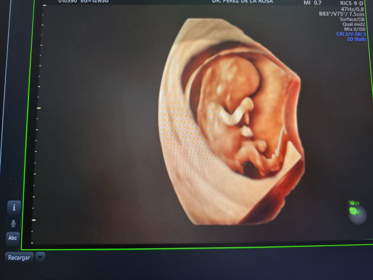 Abraham Ignacio Pérez De La Rosa-22