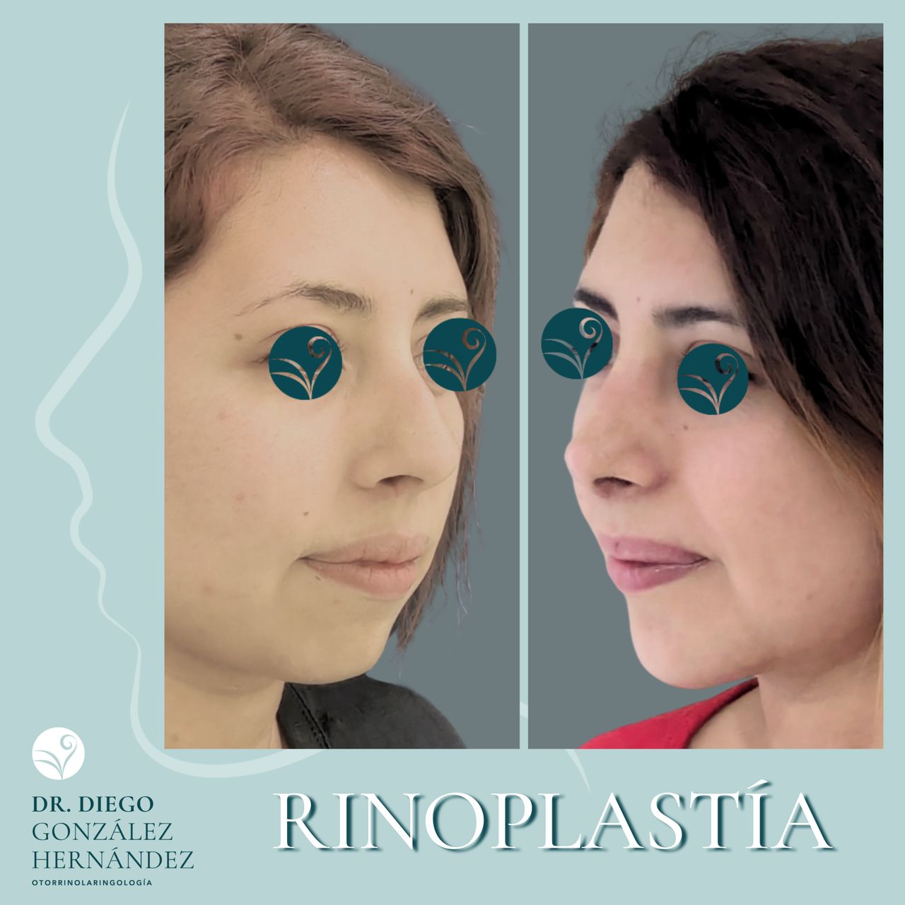 Diego González Hernández-1