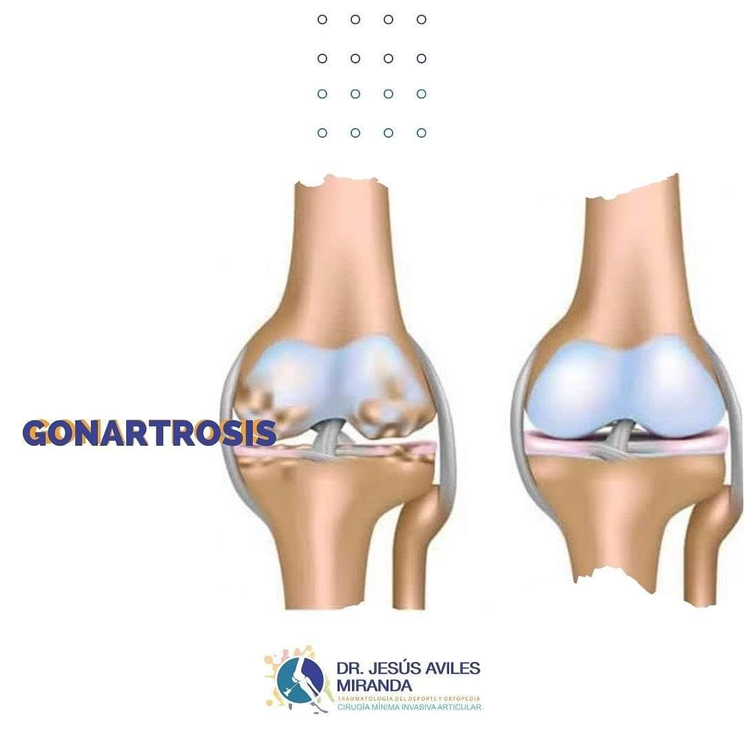 Jesús Aviles Miranda-7