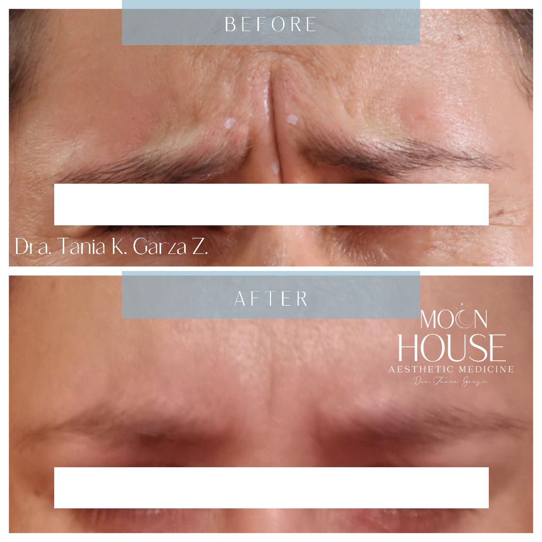 Tania Karine Garza Zepeda-3