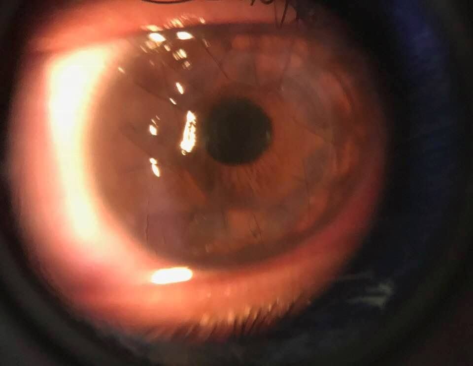 Blanca Esmeralda Hurtado Noriega-1