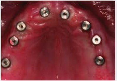 José  Luis Tapia Ibarra-10