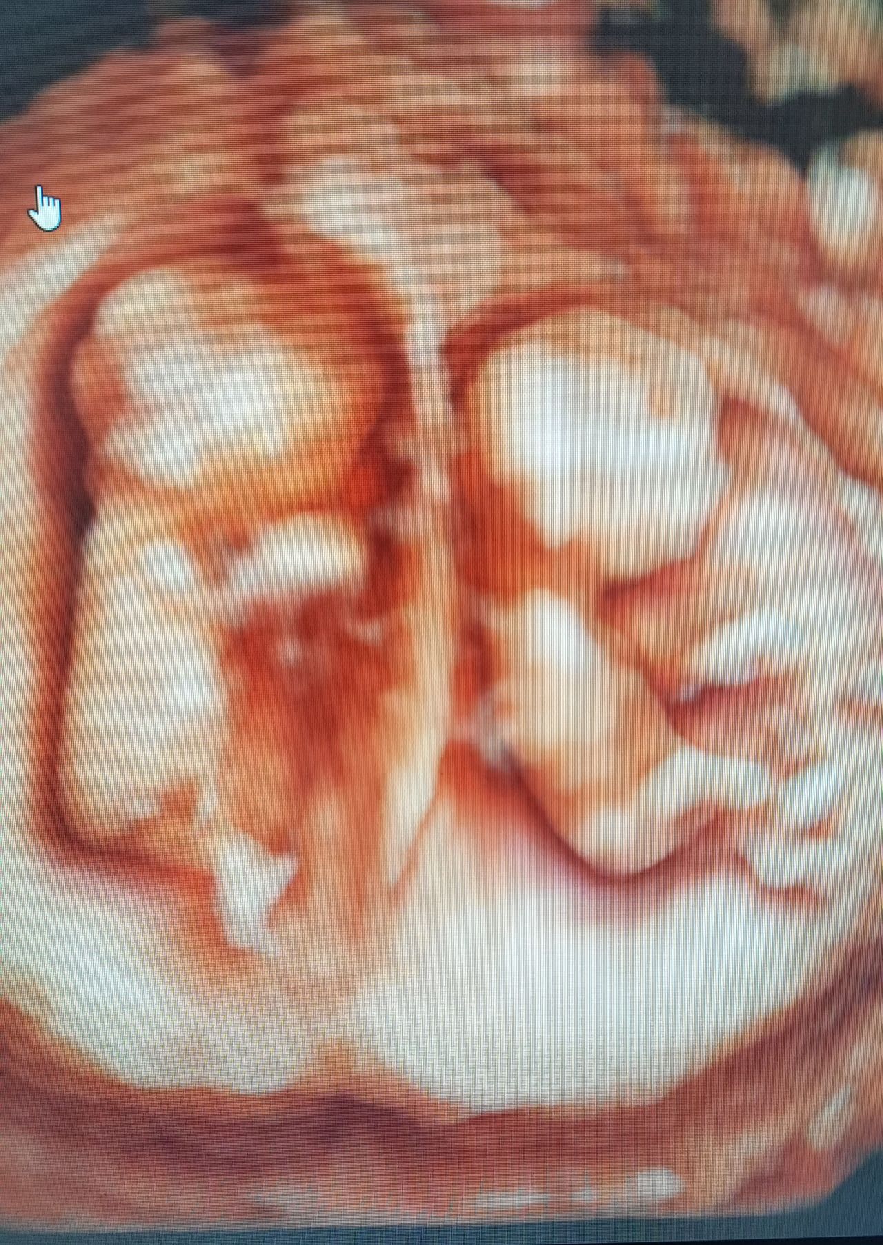 Martha Helena Cabezas Pérez-32