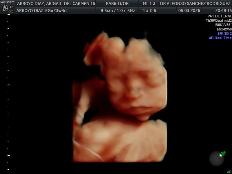 Alfonso Sanchez Rodriguez-64