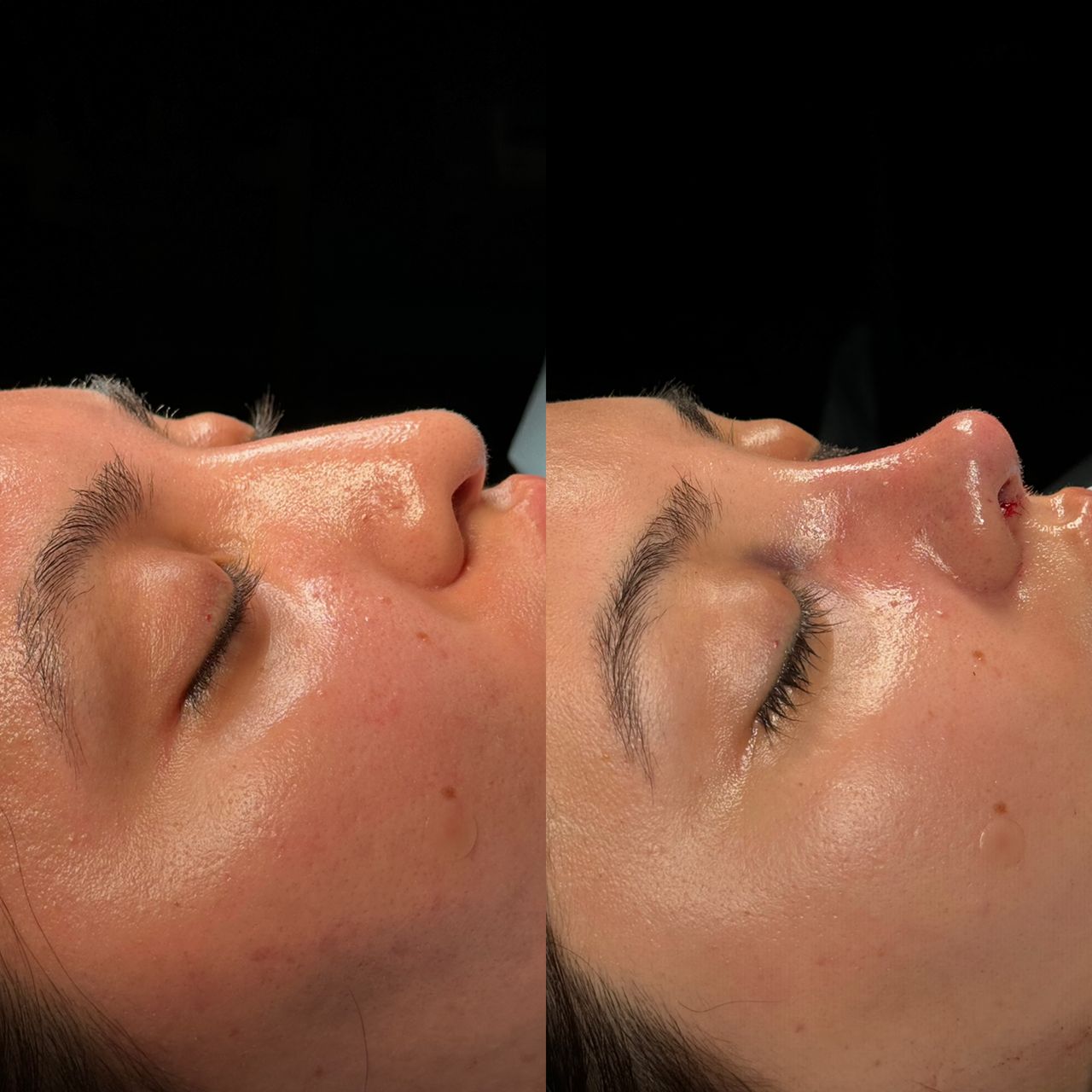 Angel Castro Urquizo-105