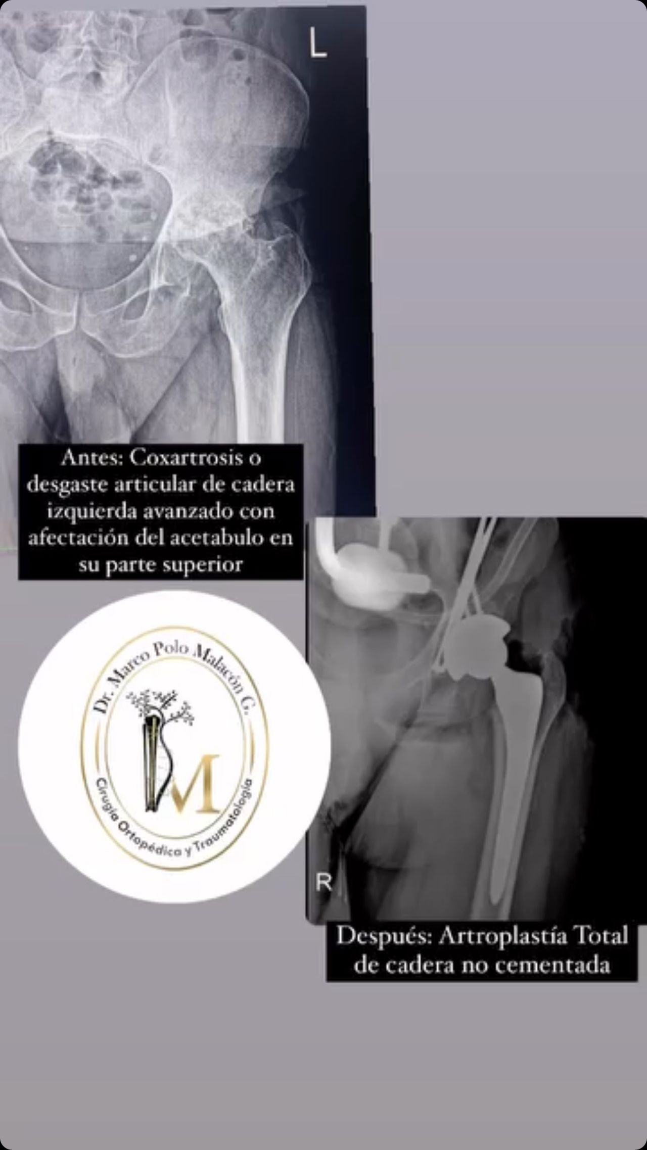 Marco Polo Malacón Gutiérrez-26