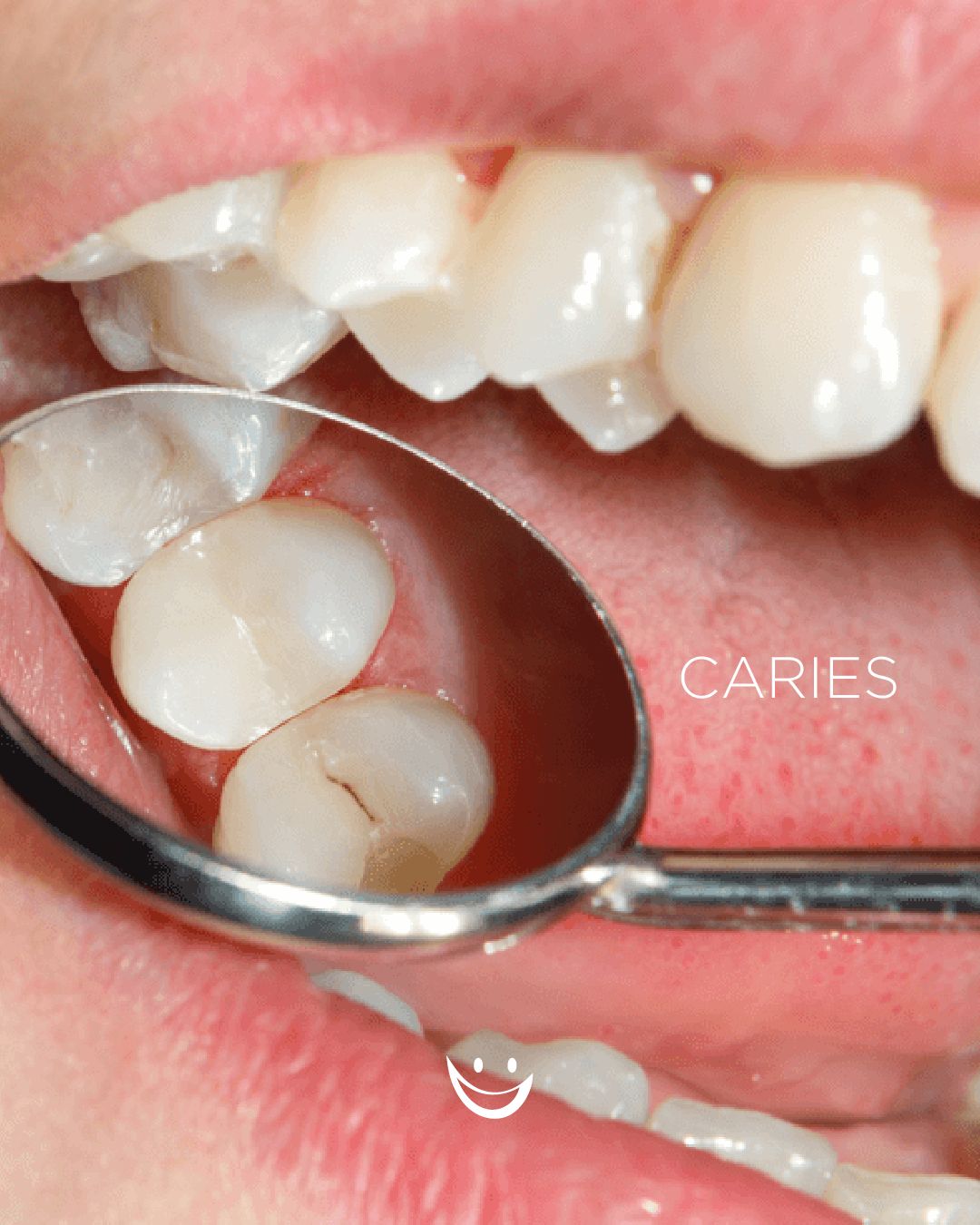 Diana De La Torre Priego-13