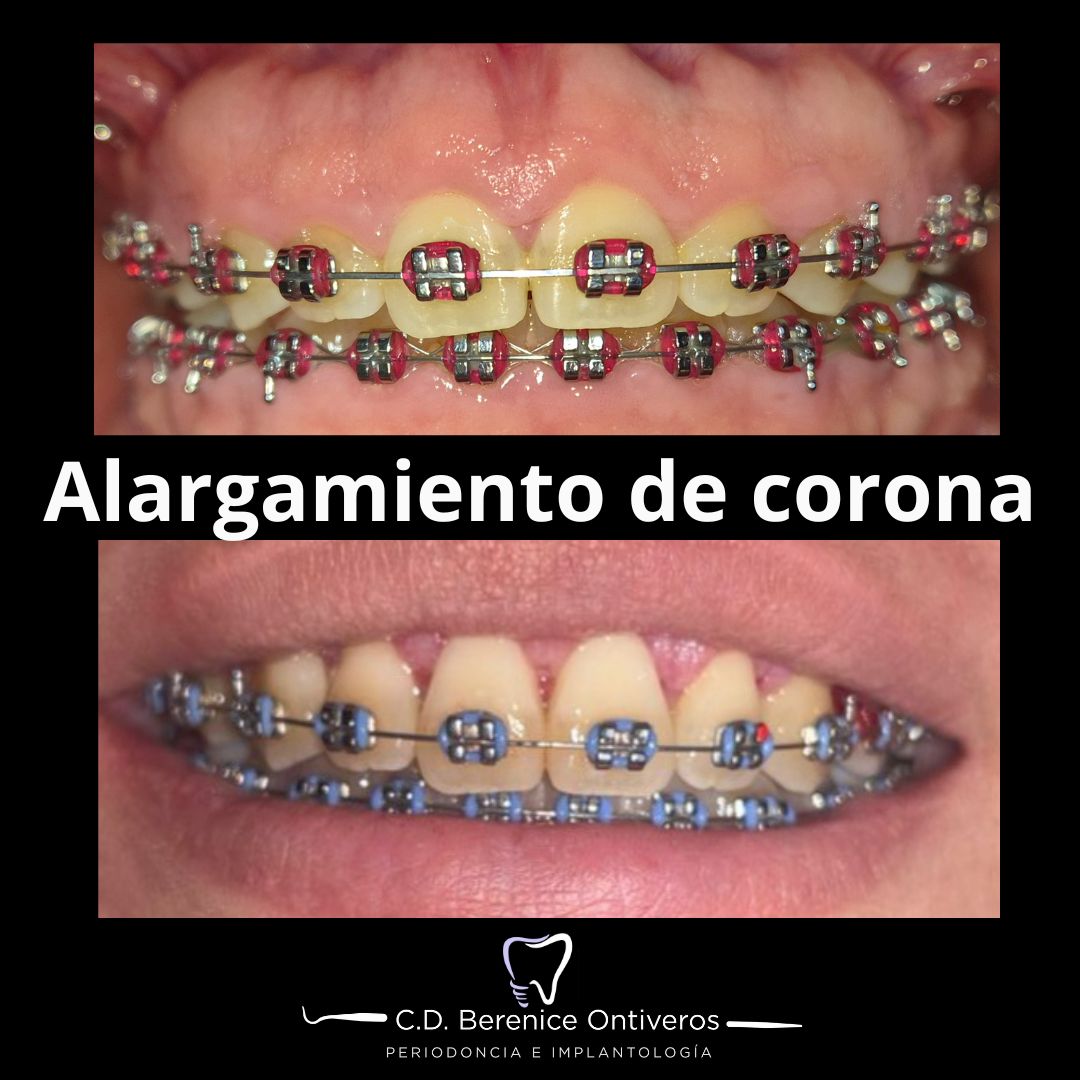 Berenice Ontiveros-10