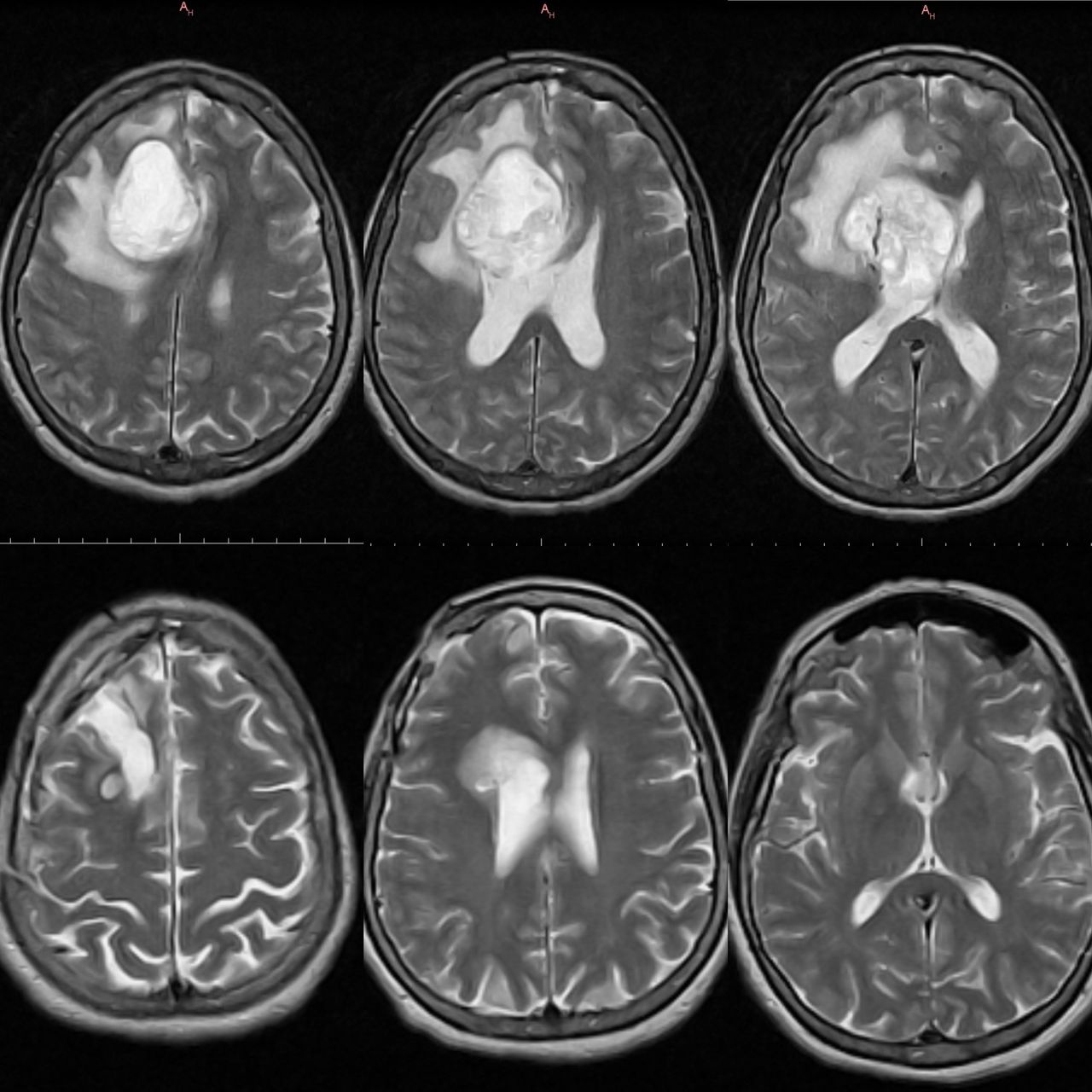 Celia Teresa De Jesús Álvarez Gamiño-36