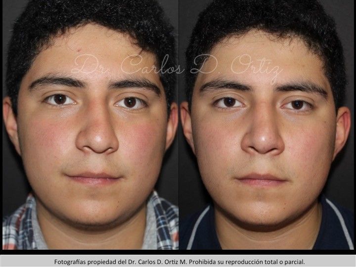 Carlos David Ortiz Moreno-18