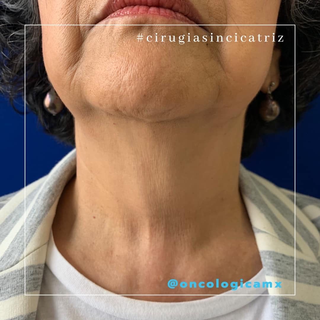 Manuel Acuña Tovar-8