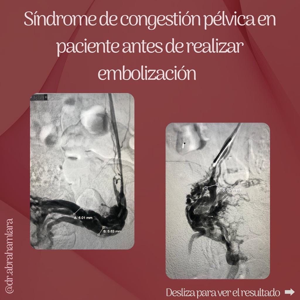 Miguel Abraham Lara Perez-24