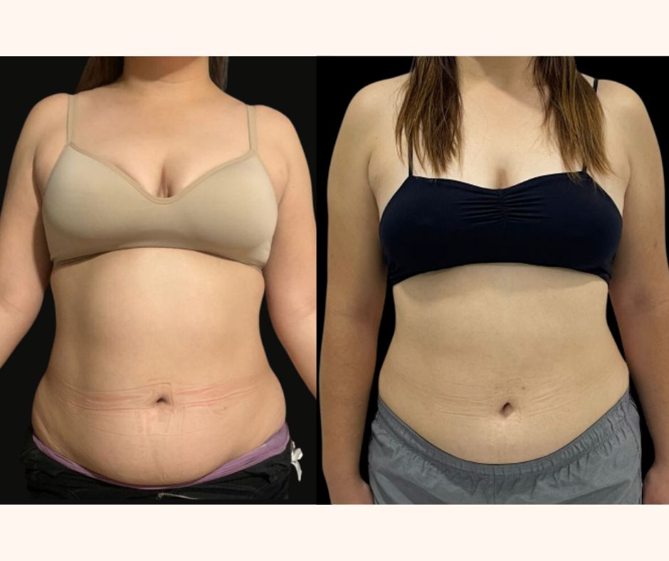 Alejandra Gutierrez García-28