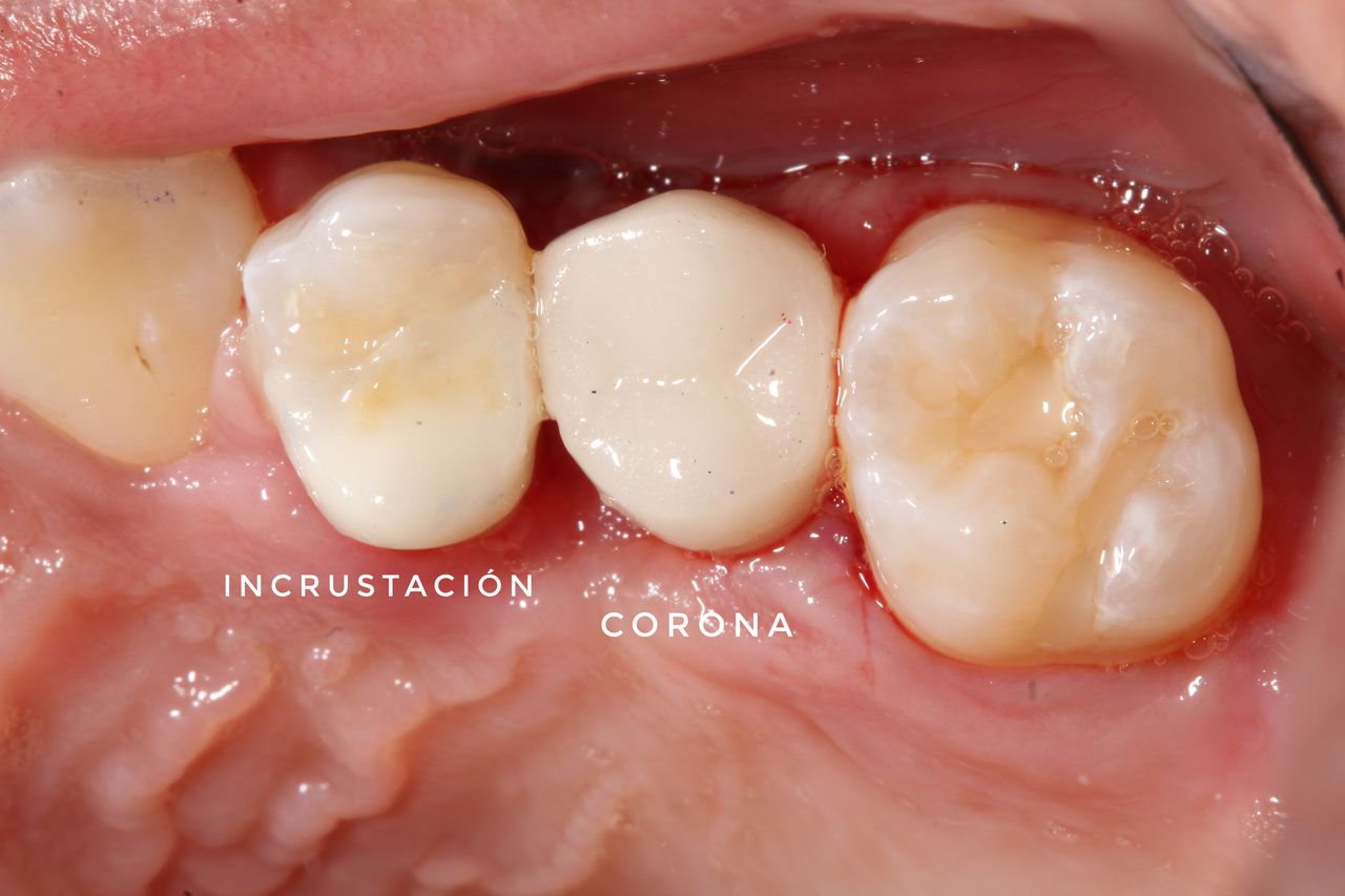 Hylse Najera Moya-21