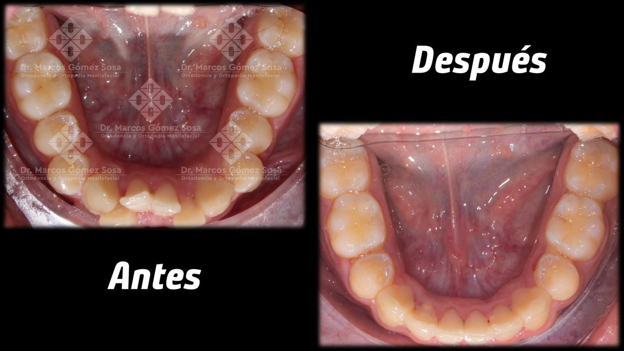 Marcos Gómez Sosa-17