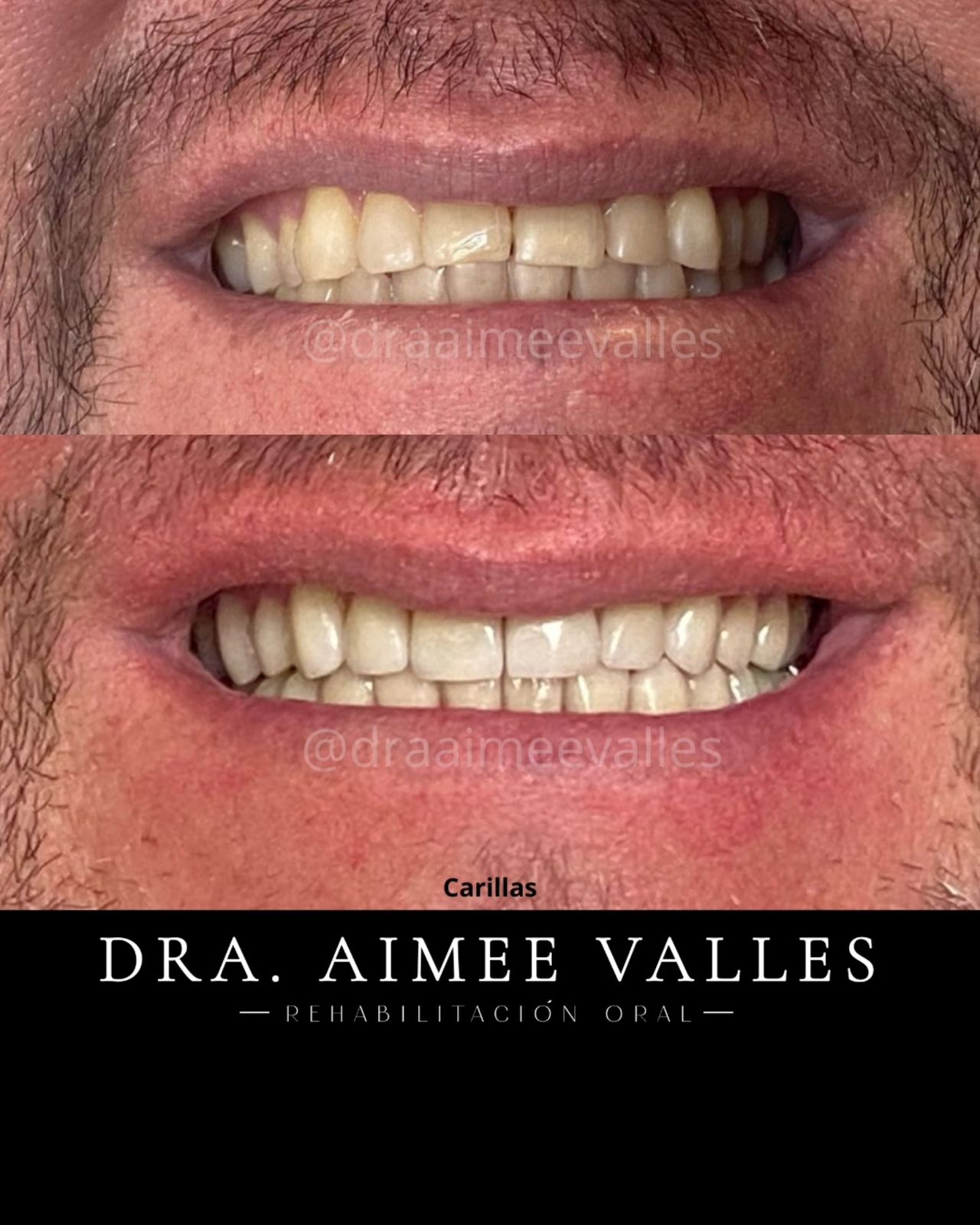 Aimee Valles Monárrez-49