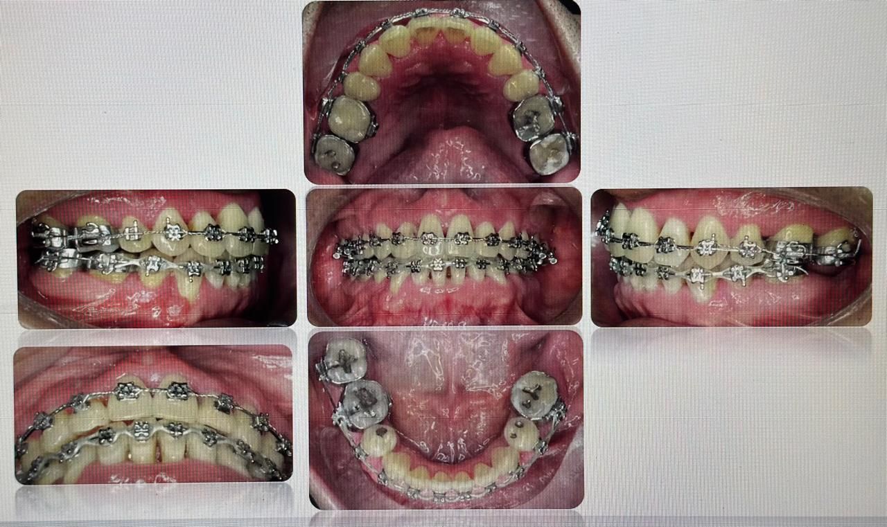 Antonio Gomez Arenas-5