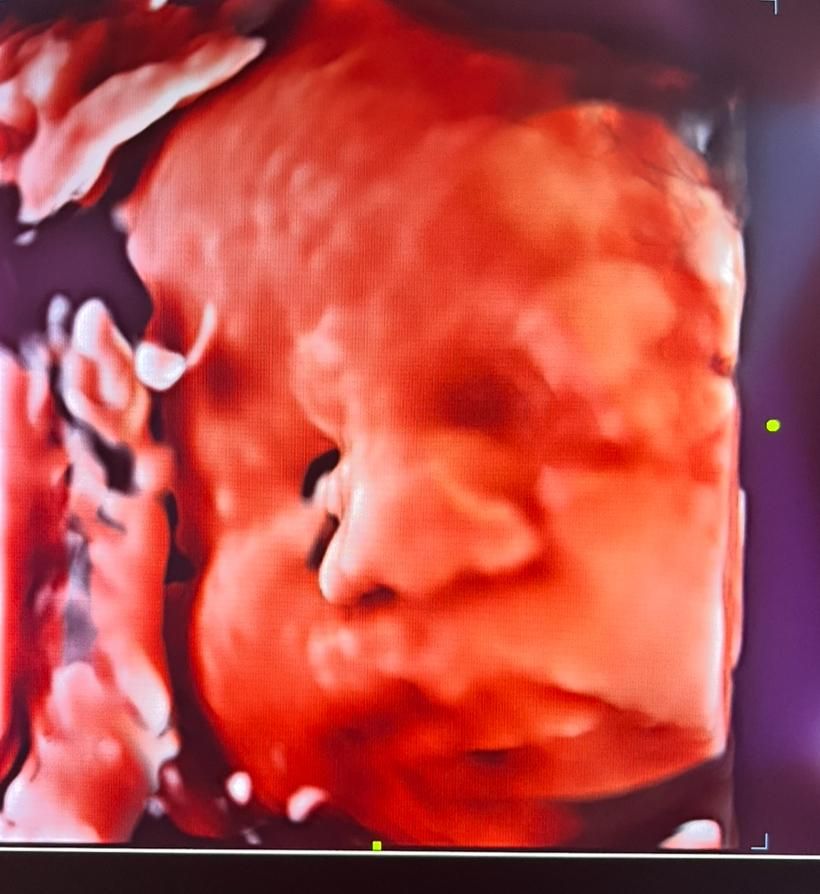 Fernando Santana Peña-7