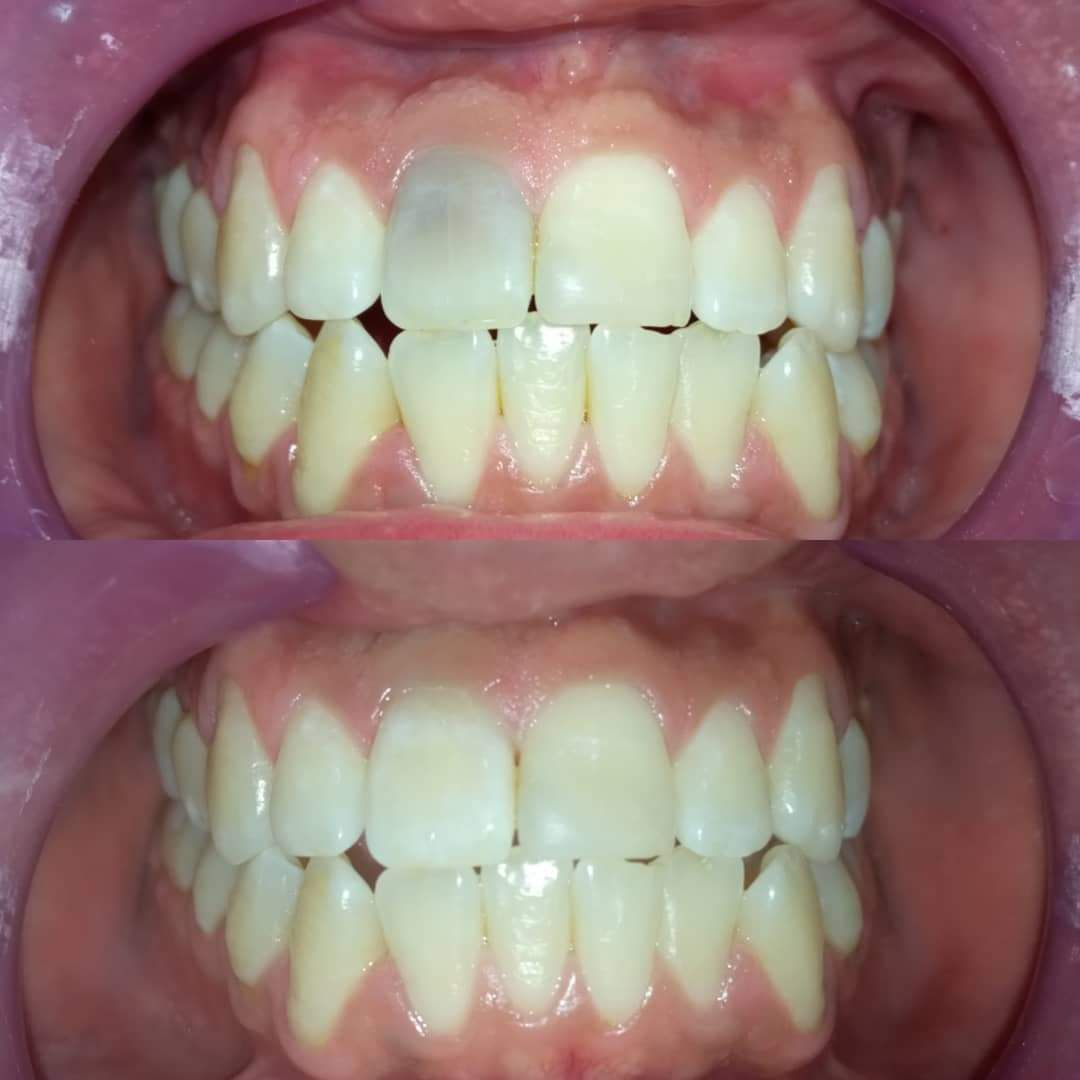 Jacqueline Nuñez Herrera-13