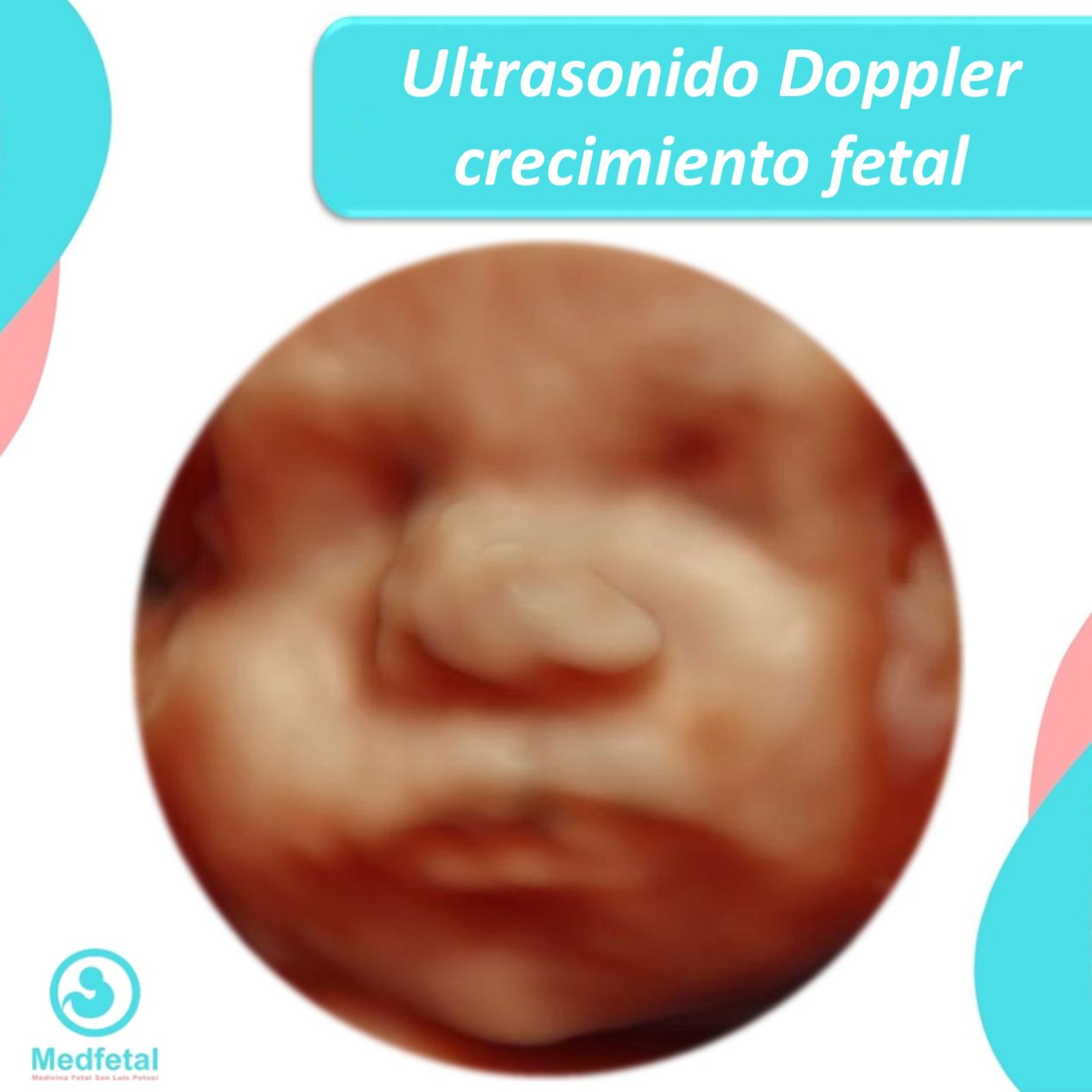 Manuel Ulises Reyes Hernández-11