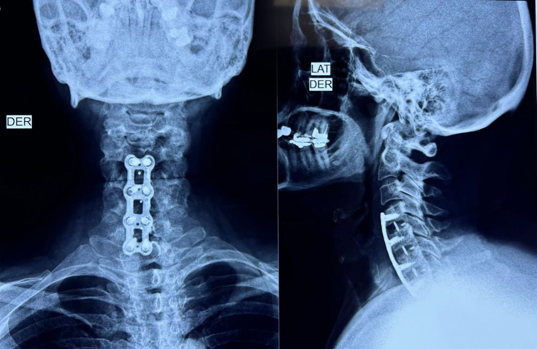 Gisela Cleto Zepeda-94