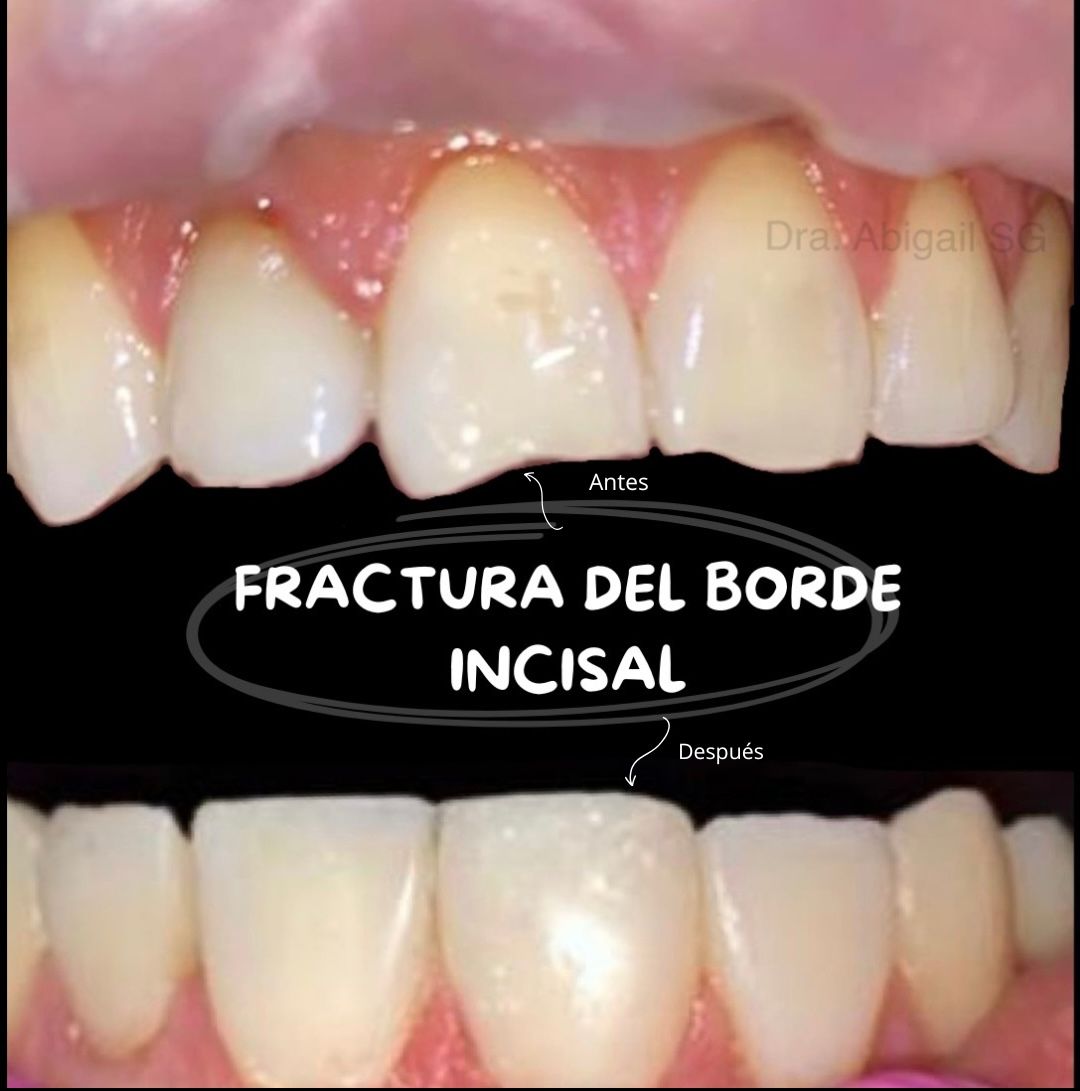 Abigail Sámano García-4