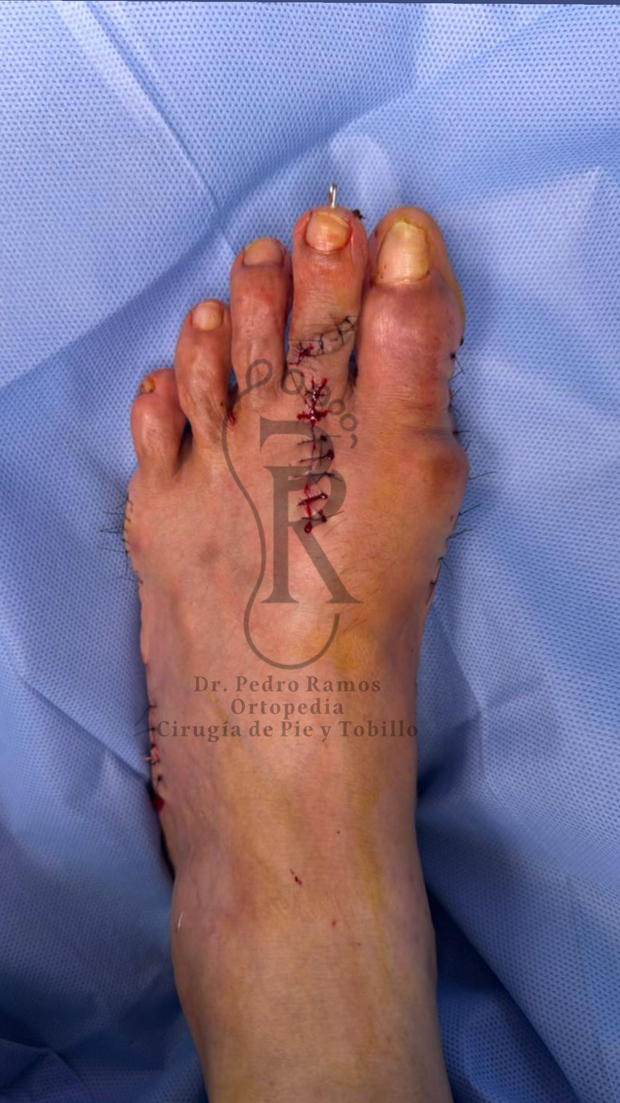 Pedro Ramos Jurado-7