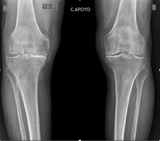 Fernando Ortiz Romero-18