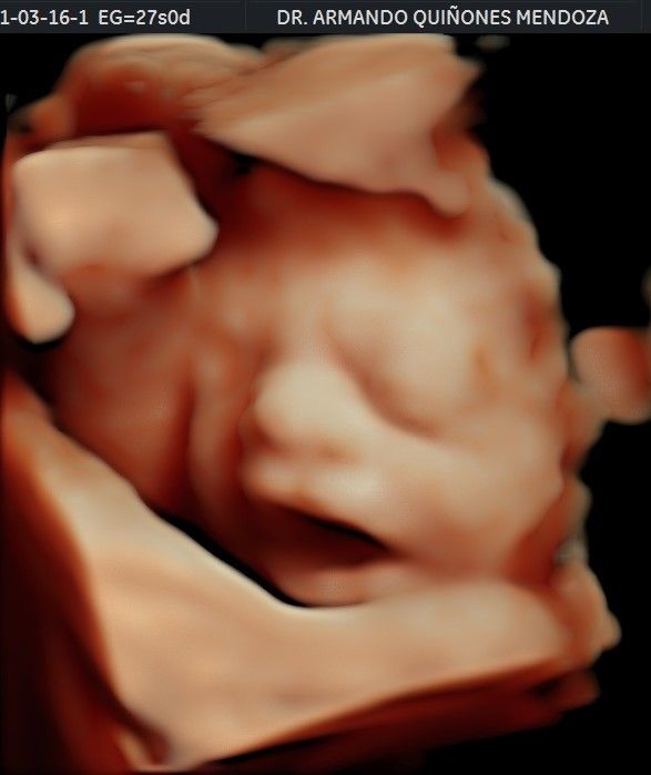 Armando Quiñones Mendoza-10