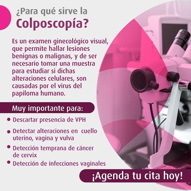 José Israel Aguirre Pérez-17