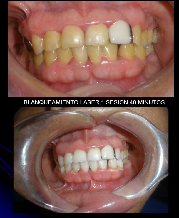 Victor Hugo Sepulveda Núñez-2