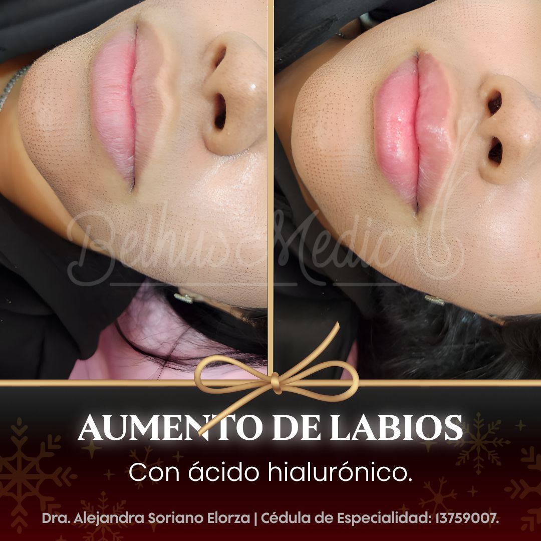 Alejandra Soriano Elorza-82