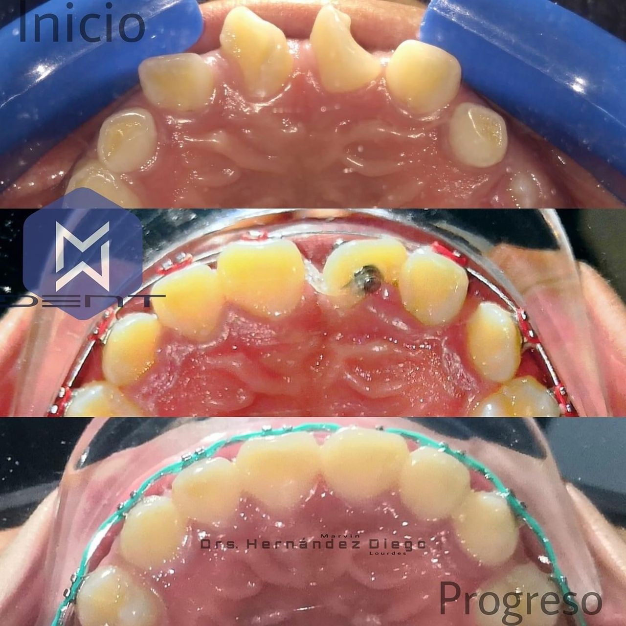 Marvin Adair Hernández Álvarez-50