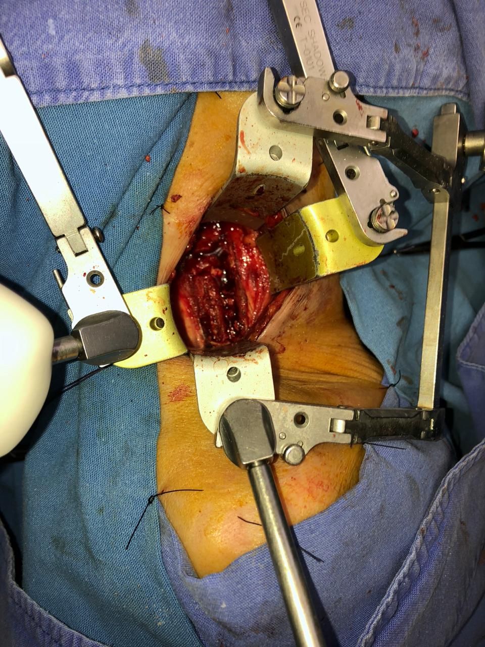 Juan José Luévano De La Cruz-14