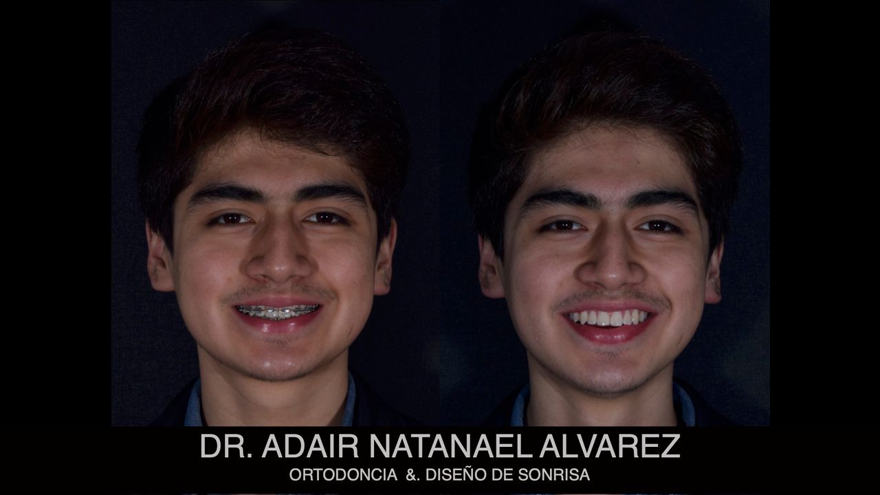 Adair Natanael Alvarez Castañeda-20