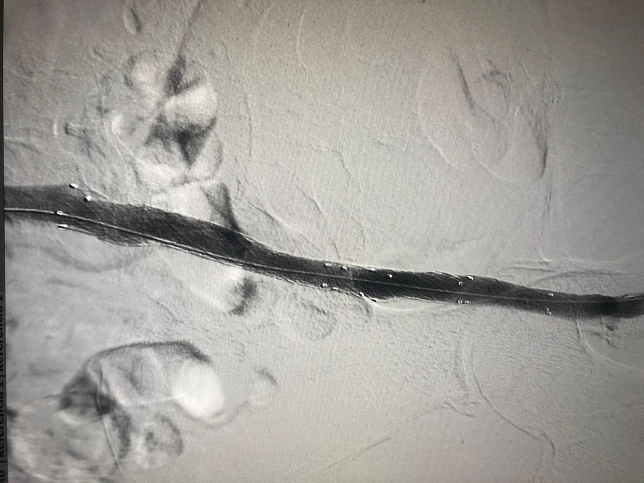 Miguel Abraham Lara Perez-13