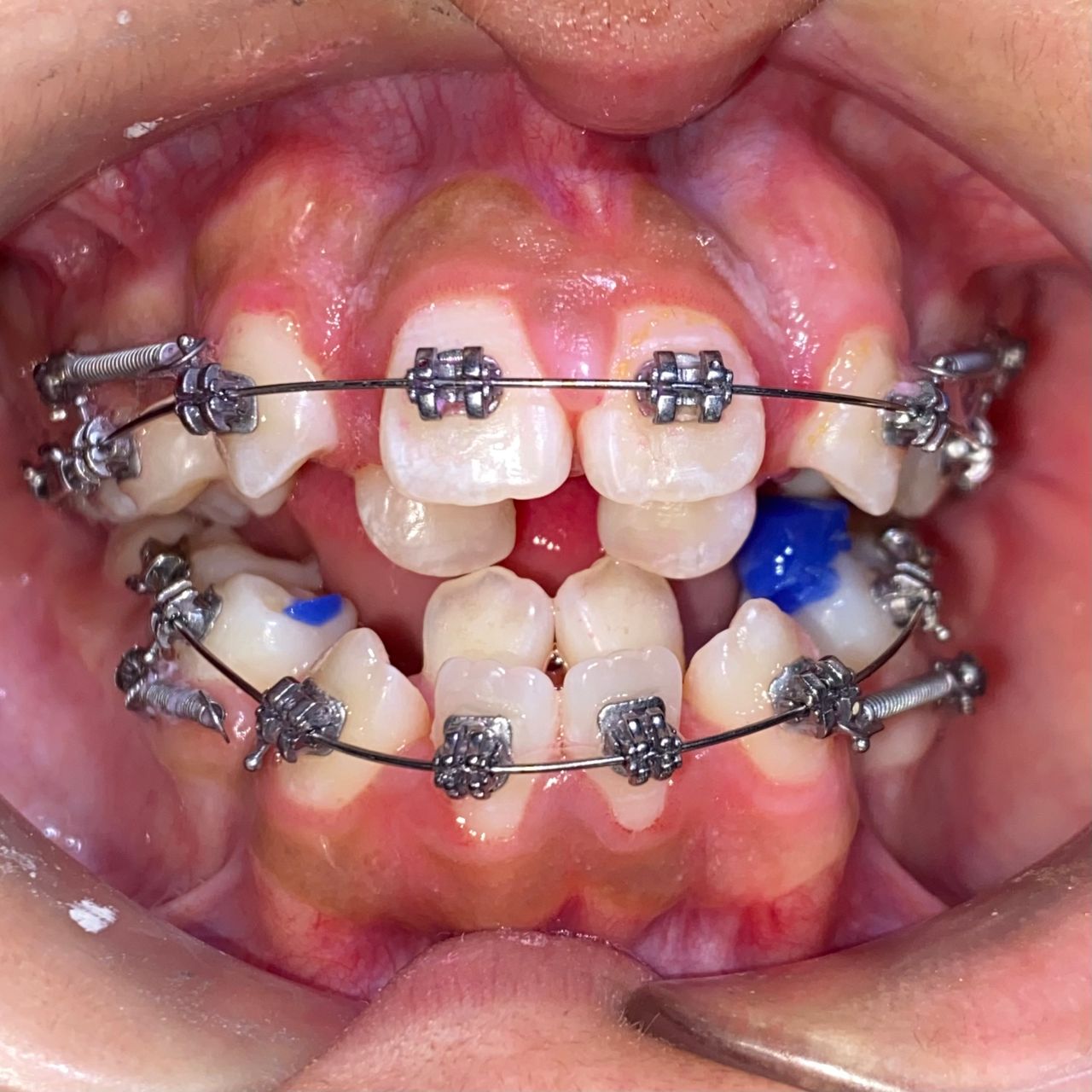 Raúl Méndez Cifuentes-26