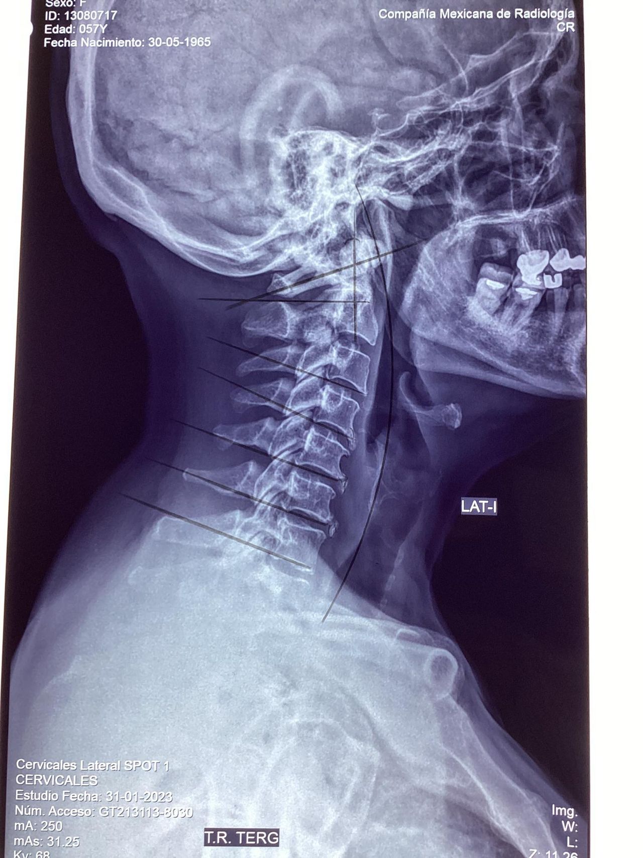 Alberto Isita Galeazzi-27