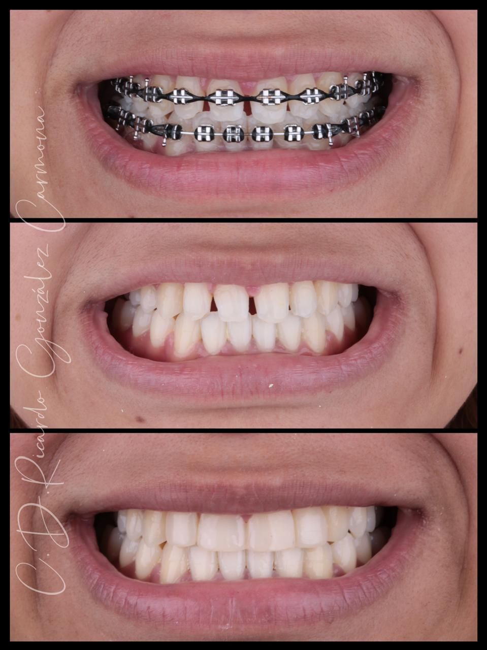 Alicia Carmona López-3