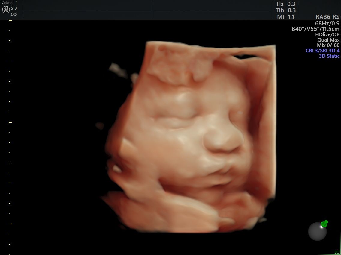 Arturo Herrera Flores-9