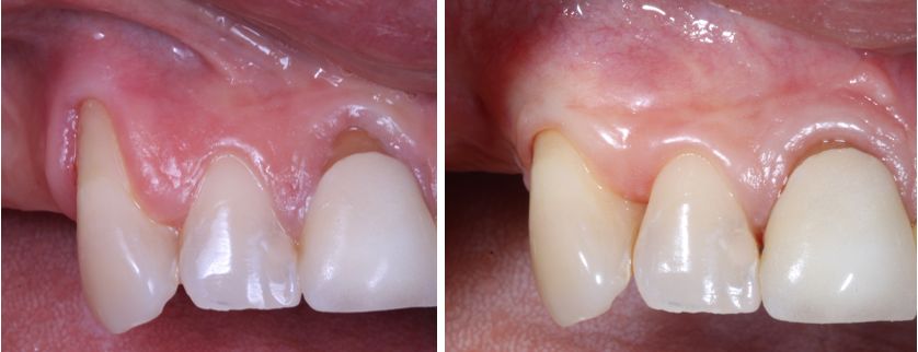 Ireri Rojas Bermúdez-12