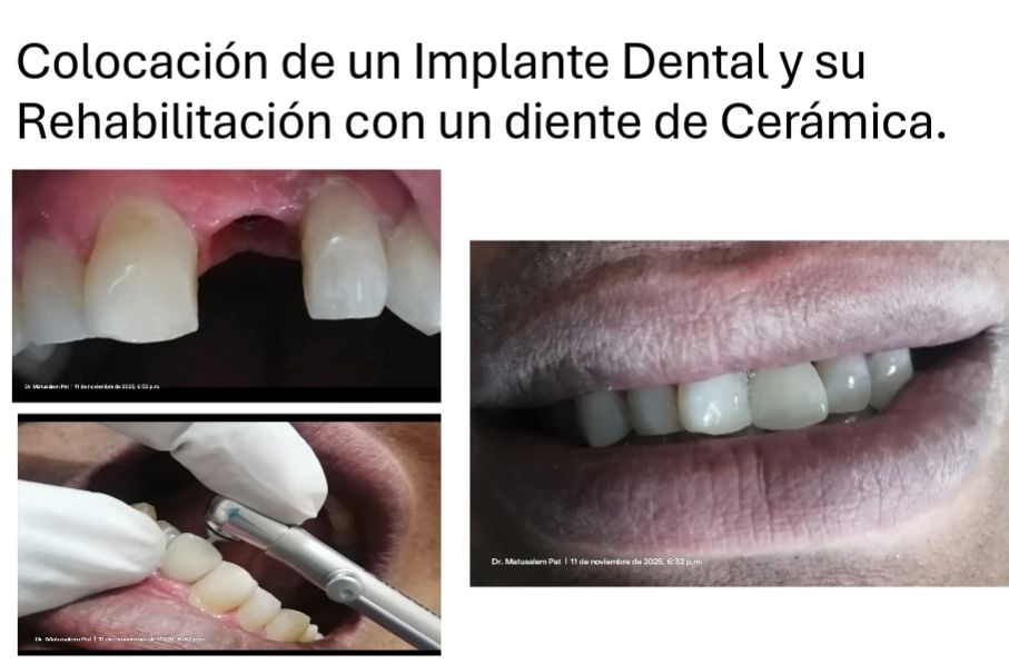 Matusalem Pat Avilés-2