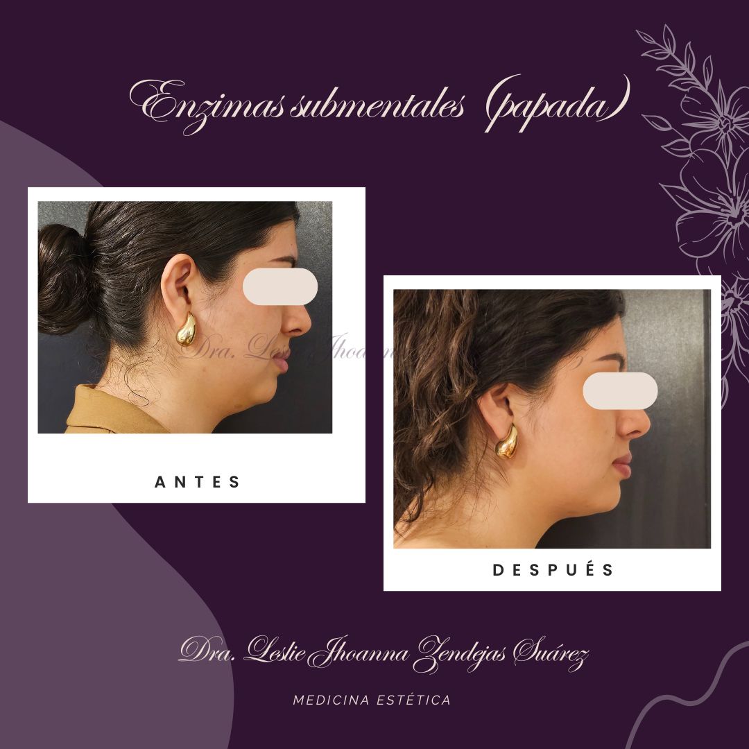 Leslie Jhoanna Zendejas Suarez-5