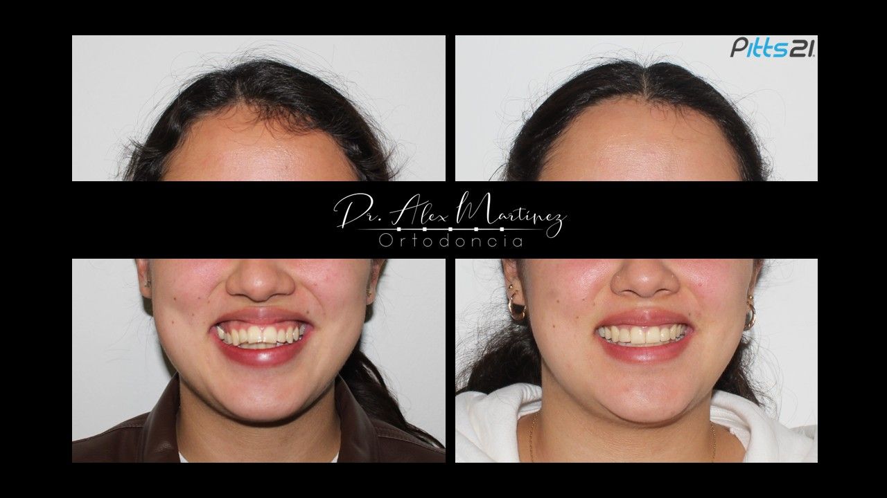 Alejandro Martínez Hernández-10