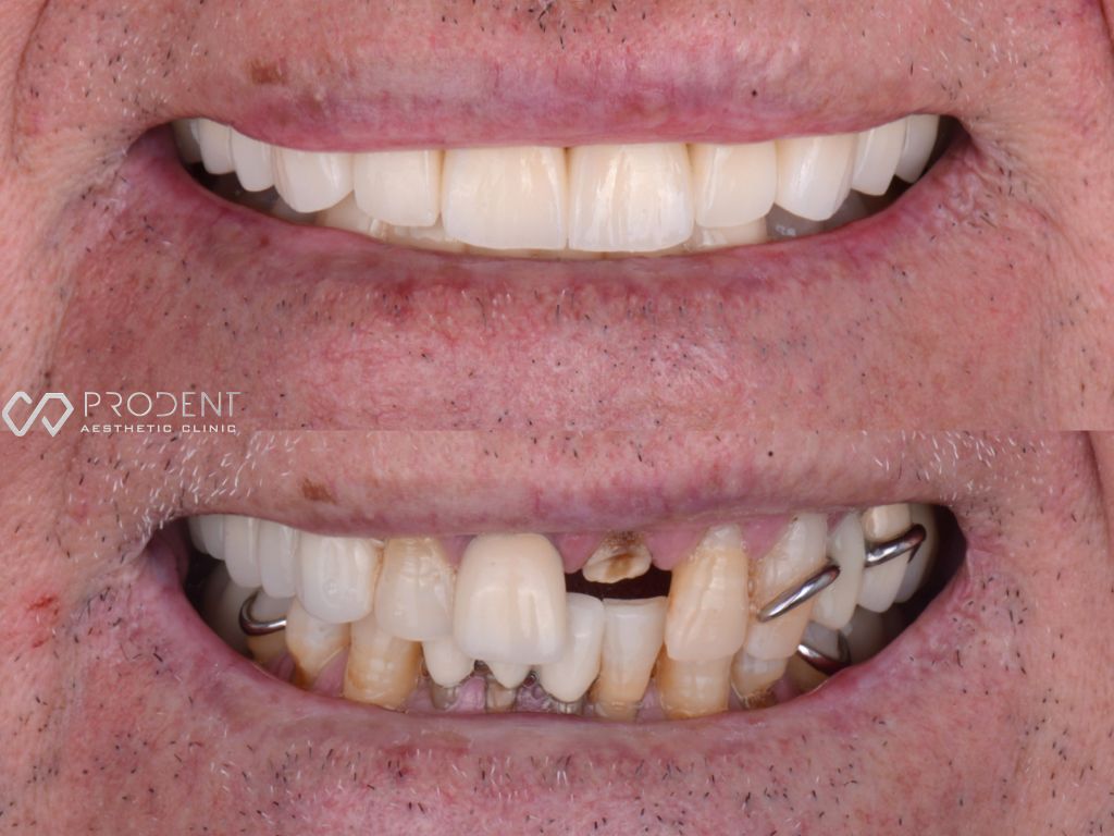 Ulises Pérez Murillo-101