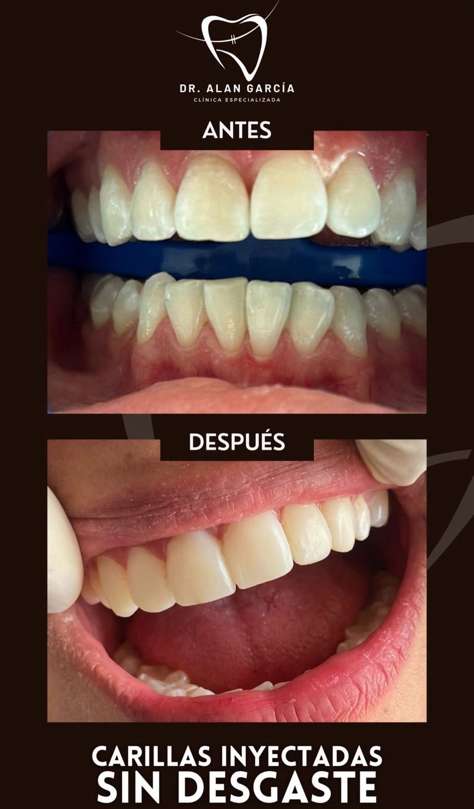 Alan Javier Garcia Vazquez-0