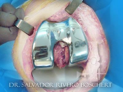 Salvador Oscar Rivero Boschert-7