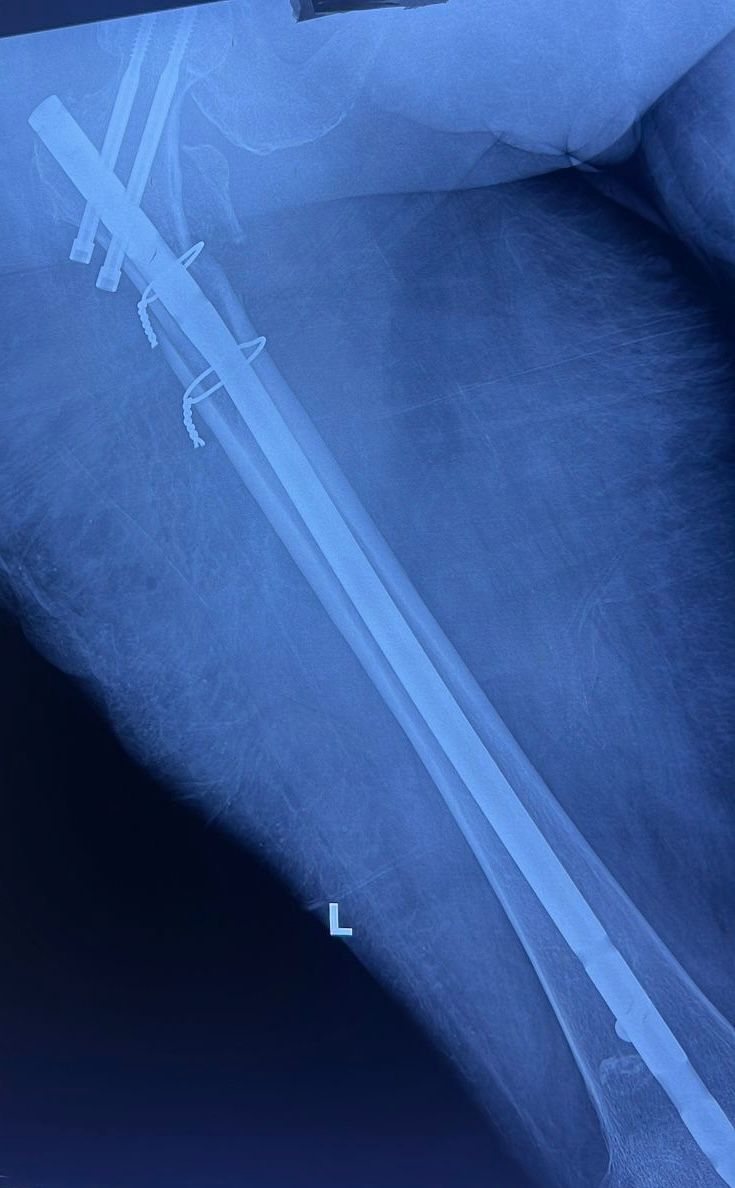 Cristian Ernesto Murillo Medina-30