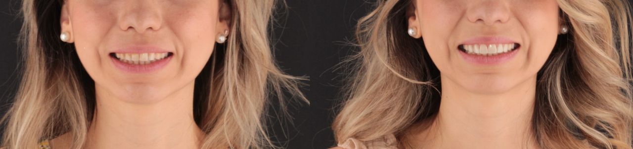 Aide Montserrat Orozco Gutierrez-52