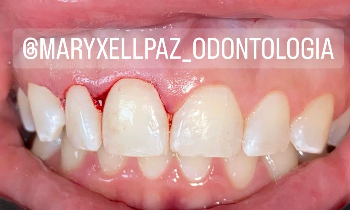 Maryxell Paz González-14